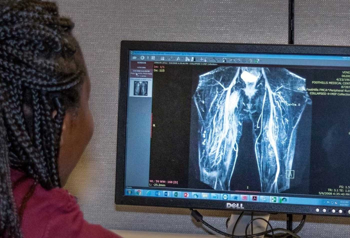 A student examines a medical diagram of the lungs on a computer screen, highlighting the hands-on research in the MS in Biomedical Informatics and Data Science.